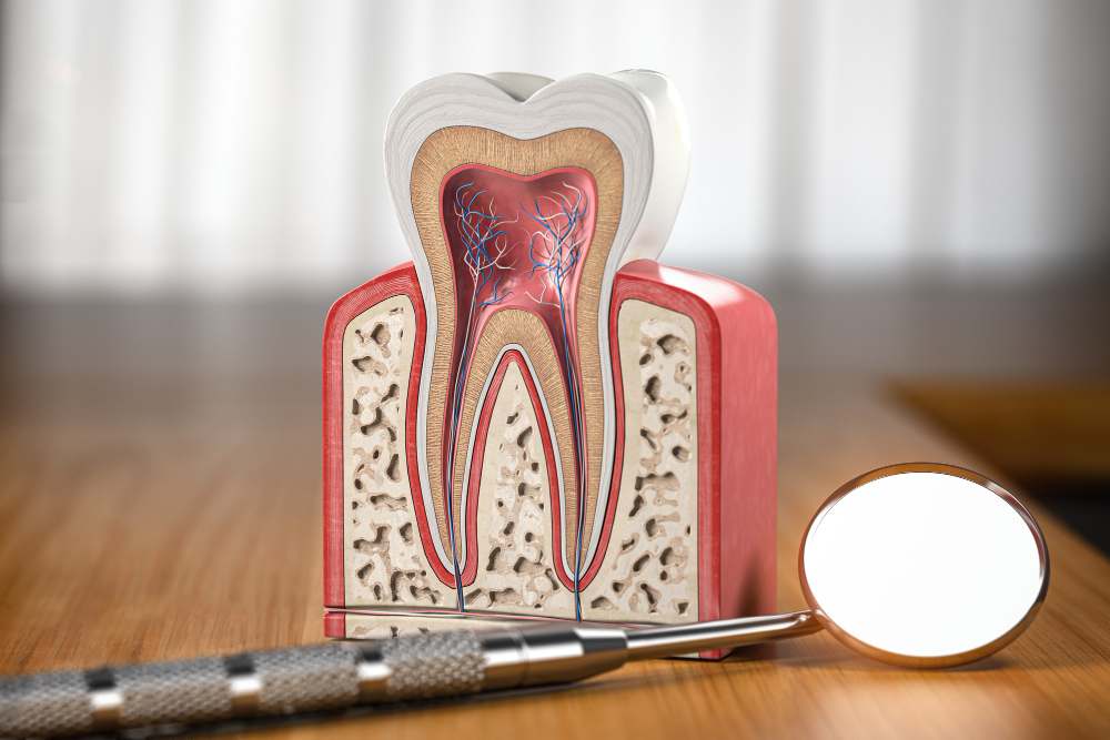 Root Canals Colorado Springs, CO